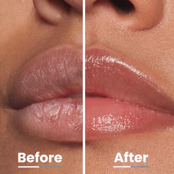 Hyphen All I Need Lipscreen with Spf 30 & 2% Kojic Acid -Moisturizing, Sun Protection|Smooth Lips, Tan Removal for Women and Men|Lip Balm Spf|Chapped Dry Lips | Peptide|Vegan,Sls & Paraben-Free -10 Gm - Image 7