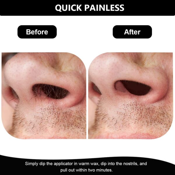 HANNEA Nose Wax Kit for Men & Women, Nose Hair Waxing Kit with 100g Nose Hair Wax Beads, Waxing Kit for Quick & Easy Nose Hair Removal - Image 6