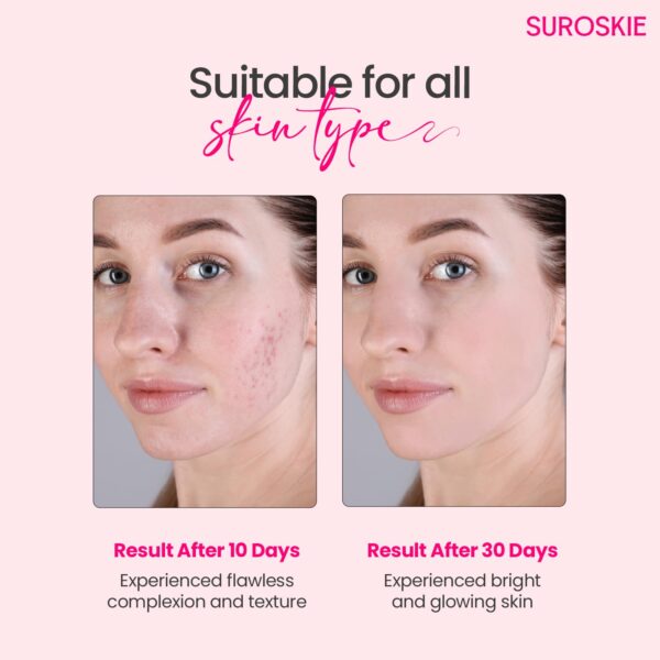 SUROSKIE Rose Glass Skin Mist 100ml | 2 in 1 Face Toner + Makeup Setting Spray | Enriched With Rose Water & Aloe Vera | Toner For Glowing & Hydrating Skin | All Skin Types | For Men & Women - Image 10